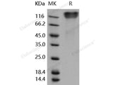 Recombinant Human OMGP/OMG Protein (aa 1-416, His Tag)