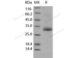 Recombinant Human Noggin/NOG Protein (His Tag)(Active)