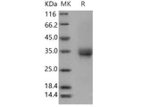 Recombinant Human CD32b/FCGR2B Protein (His &AVI Tag), Biotinylated(Active)