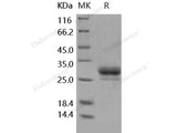 Recombinant Human CD32b/FCGR2B Protein (HEK293 Cells, His Tag)(Active)