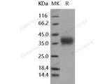 Recombinant Human Activin RIIA/ACVR2A Protein (His Tag)(Active)