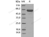 Recombinant Human Activin RIIA/ACVR2A Protein (Fc Tag)(Active)