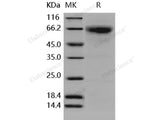 Recombinant Human MMP8/CLG1 Protein (Active)