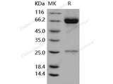 Recombinant Human MMP8/CLG1 Protein (His Tag)(Active)