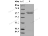 Recombinant Human IL11RA/IL11Rα Protein (His Tag)(Active)