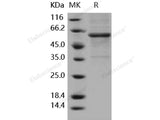 Recombinant Human METAP1 Protein (Fc Tag)