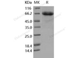 Recombinant Human EphB4/HTK Protein (Active)