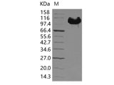 Recombinant Human EphB4/HTK Protein (Fc Tag)(Active)