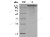 Recombinant Human LDLR Protein (His Tag)(Active)