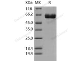 Recombinant Human ACVR2B/ActivinR-IIB Protein (Fc Tag)(Active)