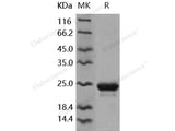 Recombinant Human NGAL/Lipocalin-2 Protein (His Tag)(Active)