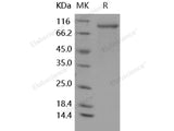 Recombinant Human G-CSFR/CD114 Protein (His Tag)(Active)