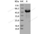 Recombinant Human GFRA3/GFR-alpha-3 Protein (His Tag)