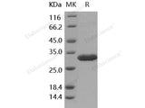 Recombinant Human Latexin/LXN Protein (His Tag)