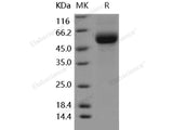 Recombinant Human DDR2 Kinase/CD167b Protein (His Tag)