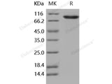 Recombinant Human DDR2 Kinase/CD167b Protein (Fc Tag)(Active)