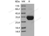 Recombinant Human Layilin/LAYN Protein (His Tag)