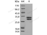 Recombinant Human JAM-A/F11R Protein (His Tag)(Active)