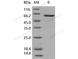 Recombinant Human JAM-A/F11R Protein (Fc Tag)(Active)