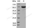 Recombinant Human EphB6 Protein (His Tag)(Active)