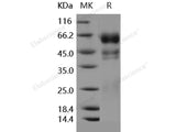 Recombinant Human PROC1/Protein C/PROC Protein (His Tag)