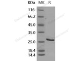 Recombinant Human BCL2/Bcl-2 Protein (His Tag)(Active)