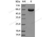 Recombinant Human ESAM Protein (aa 1-248, Fc Tag)