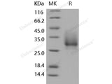 Recombinant Human CD147/Basigin Protein (His Tag)