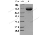 Recombinant Human CD147/Basigin Protein (Fc Tag)