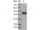 Recombinant Human S100A4 Protein (Fc Tag)