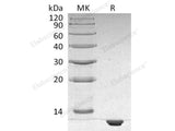 Recombinant Human S100B Protein (His Tag)(Active)