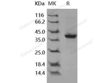 Recombinant Human S100A2 Protein (Fc Tag)