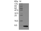 Recombinant Human S100A1 Protein (Active)