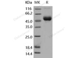 Recombinant Human IL-1R8/IL1RAPL1 Protein (aa 1-354, His Tag)