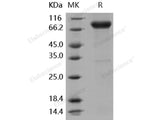 Recombinant Human IL-1R8/IL1RAPL1 Protein (Fc Tag)(Active)