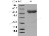 Recombinant Human IL18RAP/IL1R7 Protein (His Tag)(Active)