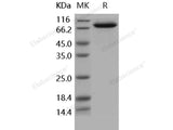 Recombinant Human IL18RAP/IL1R7 Protein (Fc Tag)