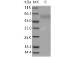 Recombinant Human DR6/TNFRSF21 Protein