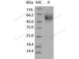 Recombinant Human DR6/TNFRSF21 Protein (His Tag)(Active)