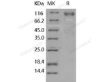 Recombinant Human Contactin 3/CNTN3 Protein (708 Asp/Asn, Fc Tag)(Active)