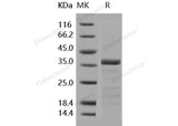 Recombinant Human tPA/PLAT Protein