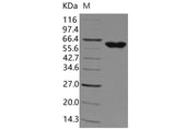 Recombinant Human tPA/PLAT Protein (aa 311-562, Fc Tag)