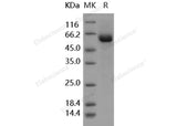 Recombinant Human tPA/PLAT Protein (aa 37-310, Fc Tag)