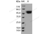 Recombinant Human IL-1R9/IL1RAPL2 Protein (His Tag)(Active)