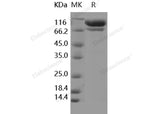 Recombinant Human C2/Complement Component 2 Protein (His Tag)(Active)