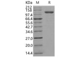 Recombinant Human Endoglin/CD105 Protein (Fc Tag)(Active)