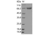 Recombinant Human TLR4/CD284 Protein (His Tag)