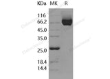 Recombinant Human CHL-1 Protein (His Tag)(Active)