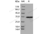 Recombinant Human IL-1 beta/IL1B Protein (pro form, His Tag)(Active)