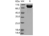 Recombinant Human PIGR Protein (365 Ser/Gly, His Tag)(Active)